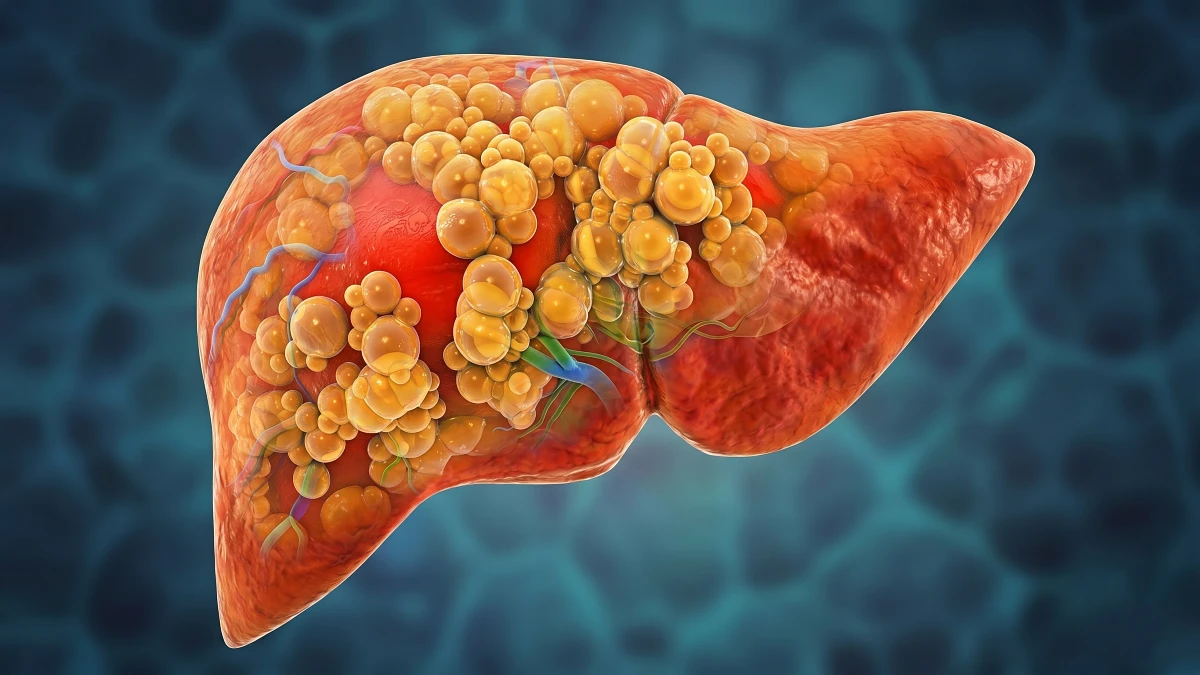 Liver Health